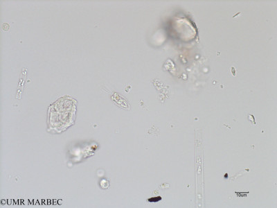 phyto/French_Polynesia/Arutua/ECOPE Janvier 2017/Halosphaera viridis (ancien Flagellés sp1-C1A_S1R2_050117-3).tif(copy)_thumb.jpg